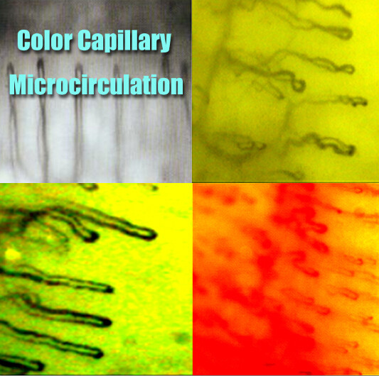 China Hospital Nailfold Capillary Microscopy /  Microcirculation Microscope Multi Function for Medical wholesale