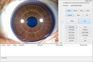 China 12.0MP Digital Iriscope Iridology Camera Eye Testing Machine CE/DHL Approval wholesale