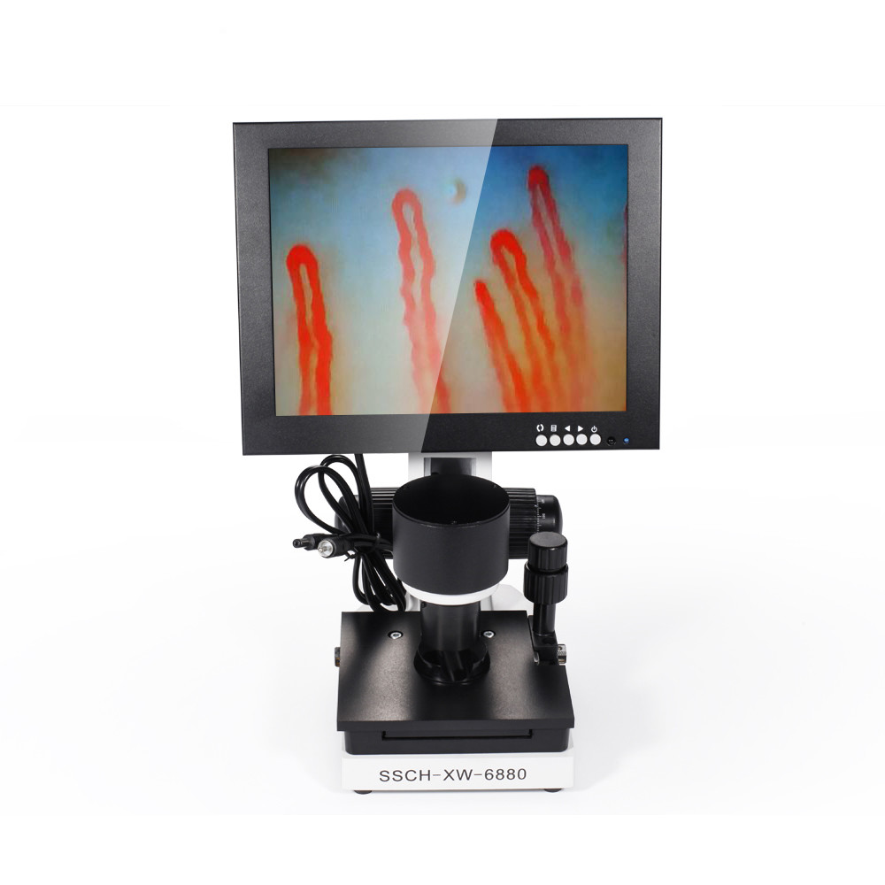 China LCD Digital Biological Microscope Microcirculation Checking Capillary Microscope wholesale