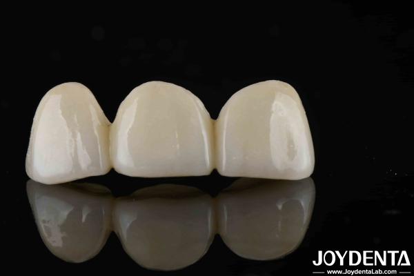 Quality Natural-looking Style With Layers Full Zirconia High Translucency And Aesthetics for sale