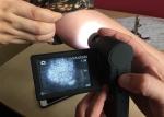 Handheld Dermatoscope Digital Skin Analyzer 5M Pixels Supported PC of Window