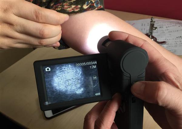 Handheld Dermatoscope Digital Skin Analyzer 5M Pixels Supported PC of Window
