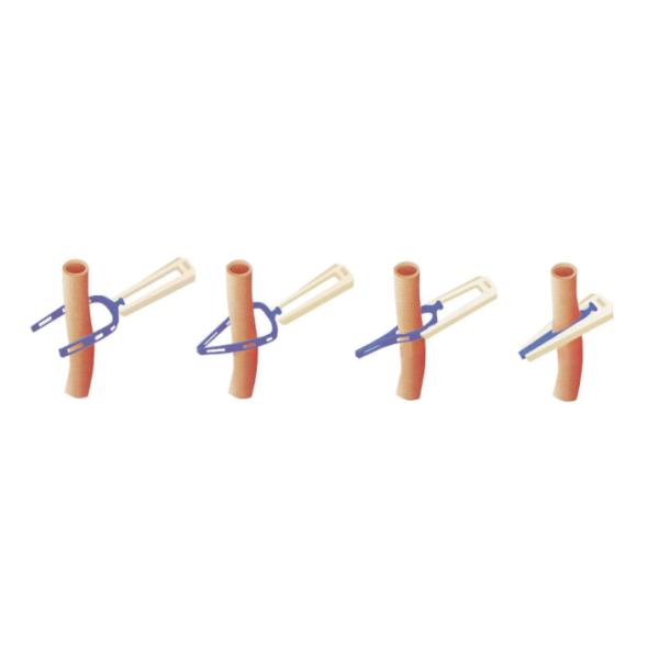 Complete Absorption Alligaclip TM Absorbable Laparoscopic Hemoclips