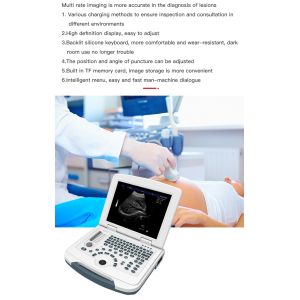 Multilingual USB Port Color Doppler Ultrasound Scanner PRF Adjustable