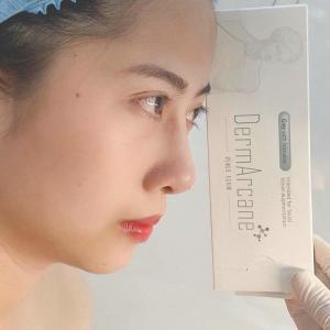 China Hyaluronic Acid Injection dermal fillers lip filler Breast Buttock Enhancement Anti Aging Dermal Filler wholesale