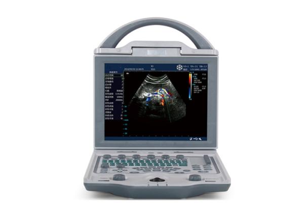 Quality Portable Echocardiography Machine Portable Ultrasound Scanner With 10.4 Inch Adjustable Monitor for sale