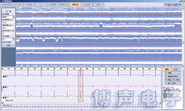 CE Approved ECG Holter 24 hr Monitor with Analysis Software iTengo 3/12 Channels