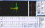 Holter ECG Software 3/12 Channels 24-Hours Ambulatory ECG Holter Monitor HRT, T