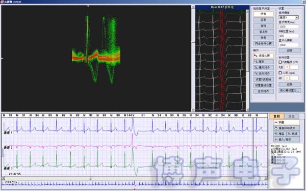 Quality Holter ECG Software 3/12 Channels 24-Hours Ambulatory ECG Holter Monitor HRT, T-wave alterans & HRV for sale