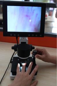 China High Definition LCD Microcirculation Checking Microscope Nailfold Video Detection Instrument wholesale