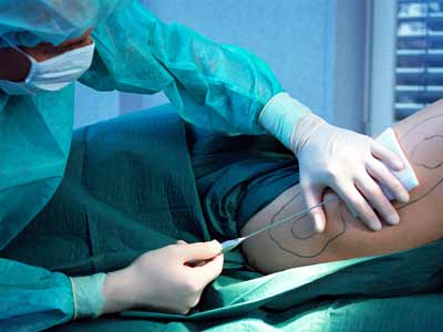 Liposuction Surgical System BS-LIPS3