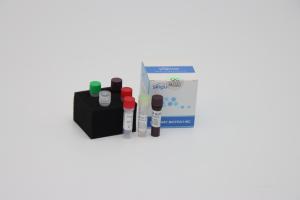 China Laboratory Multiplex Fast Real Time RT PCR Detection Kit Reagents For Sars Virus Detection on sale