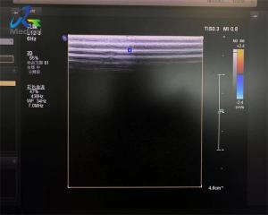 L12-3 Linear Array Transducer Probe Ultrasound Crystal And Cable Replacement