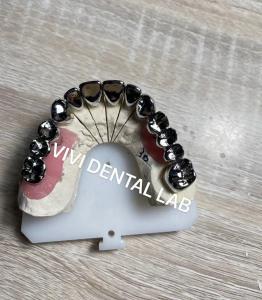 China SLM Technique Dental Lab Crowns Deformation Resistance Full Metal Crowns on sale