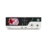 FHD Endoscopic Camera System with Build in LED Light Source and USB Storage