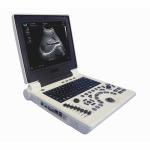 USG OB GYN Portable USG Machine IMT Automatic Measurement