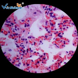 China Anatomy Histology Prepared Pathology Microscope Slides 200 Pieces Odm Service wholesale