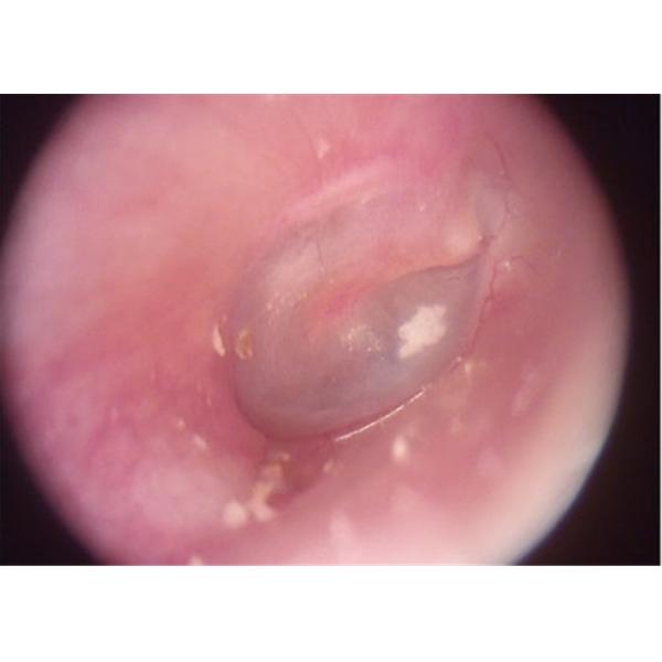 Quality Rechargeable Portable Otoscope Ophthalmoscope Dermatoscope With SD Card Output for sale