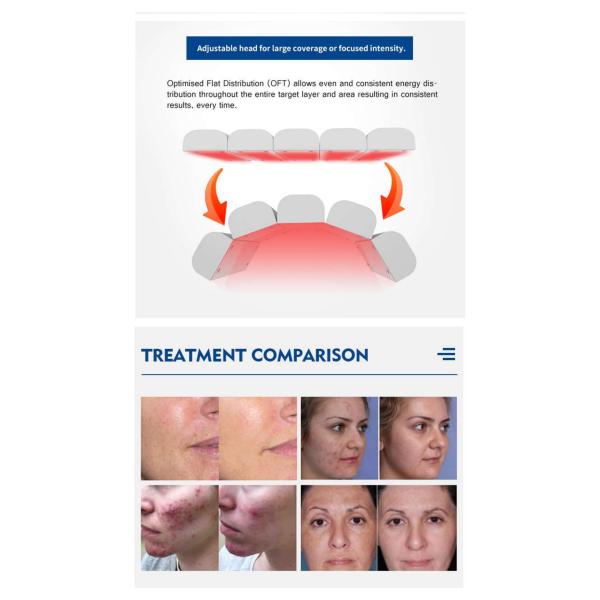 FDA Certified PDT Machine With Infrared LED Light Therapy 1500PCS LEDs 30 Min Treatment Time