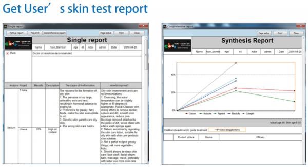 Patent Cbs Software Dino Lite 200x Times Magnified Analyzer Smart Skin Analysis Equipment