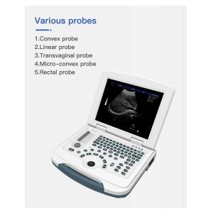 Multilingual USB Port Color Doppler Ultrasound Scanner PRF Adjustable