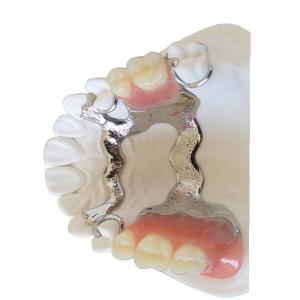 China FDA PFM Dental Bridge Good Biocompatibility 3D Printing Dental Models on sale