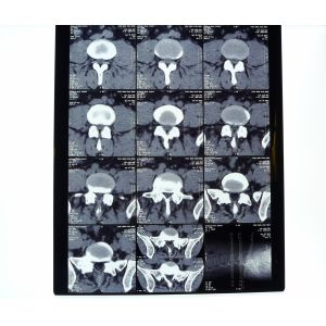 China White PET AGFA Medical Dry Film on sale