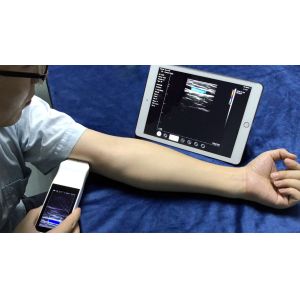 Wireless Linear Array Ultrasound Probe Handheld Wifi Ultrasound Scanner Price