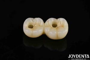 800 MPa Flexural Strength Multilayer Full Zirconia High Translucency For Durable And Natural-looking Restorations
