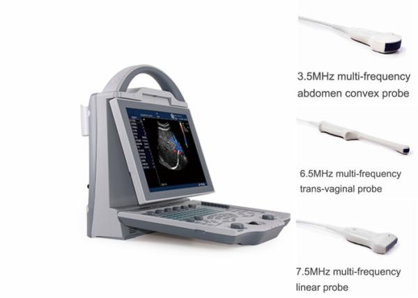 Quality Portable Pregnancy Ultrasound Scanner with Abdominal Convex Transvaginal Transducers for sale