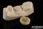 800 MPa Flexural Strength And 8 MPa·m1/2 Fracture Toughness In Multilayer Full