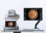 AI System Automated Fundus Camera DICOM Small Pupil Multifunctional Software