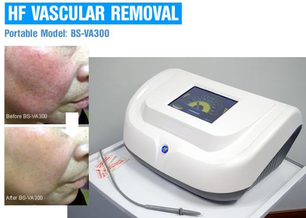 Quality High Frequency Red Blood Vascular Removal Machine With Pulse / Continuous Work Mode for sale