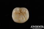 High Translucency Full Zirconia With Layers Biocompatibility And Flexural