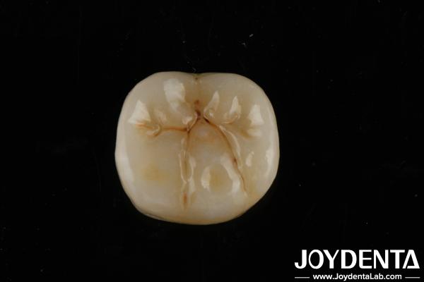 High Translucency Full Zirconia With Layers Biocompatibility And Flexural