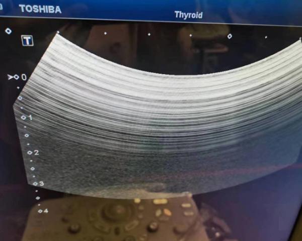Quality Toshiba PVT-375BT 6 Mhz Convex Array Probe Ultrasound Transducer For Medical Imaging for sale