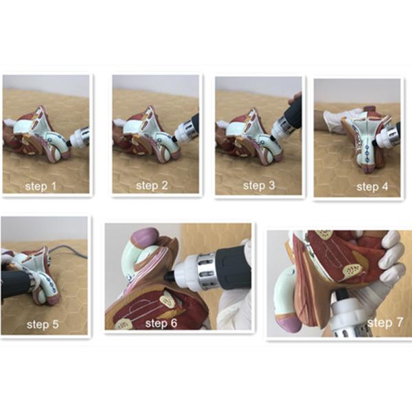 Pneumatic Electromagnetic Shockwave Therapy Machine Clinic ED Treatment