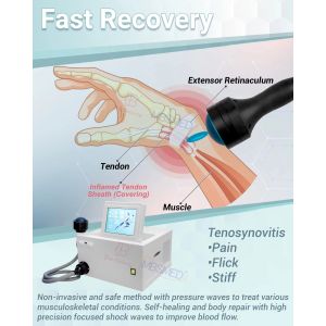 Professional Eswt Shock Wave Machine Erectile Dysfunction Ed Treatment