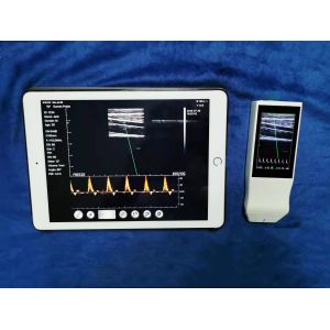 Wireless Linear Array Ultrasound Probe Handheld Wifi Ultrasound Scanner Price