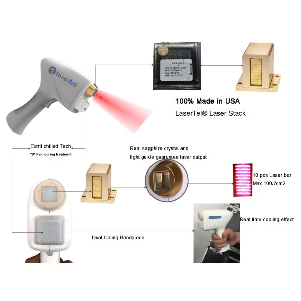 Ce Iso Focus Laser Hair Removal 808nm Diode Touch Screen