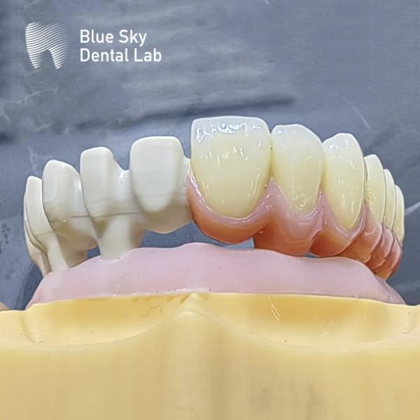 Quality Customize Color Implant Cases with Smooth Surface Nature Design for Universal Compatibility for sale