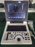 USG OB GYN Portable USG Machine IMT Automatic Measurement
