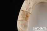 High Translucency Full Zirconia With Layers Biocompatibility And Flexural