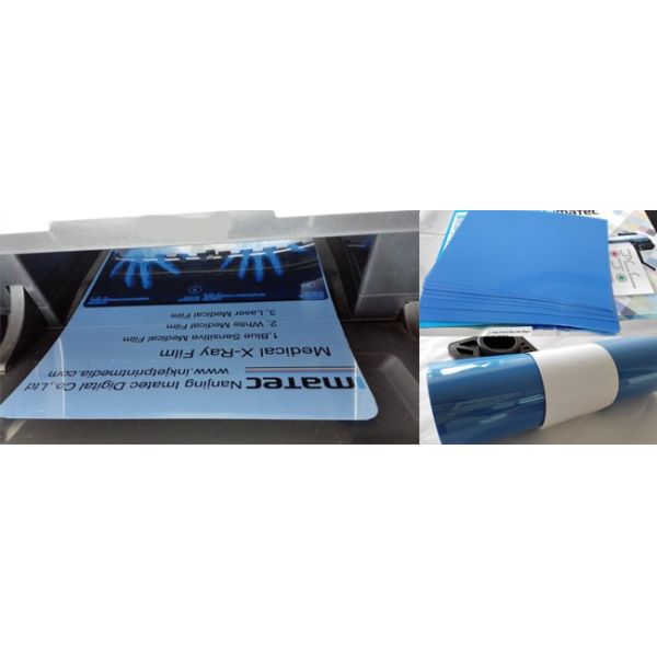 Digital Inkjet Printing Medical Imaging Film Blue X Ray For DR MRI CT