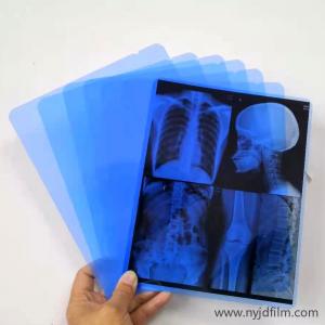 China 13x17 Inch Waterproof Laser Blue X Ray Film For Hospital Radiology Department on sale
